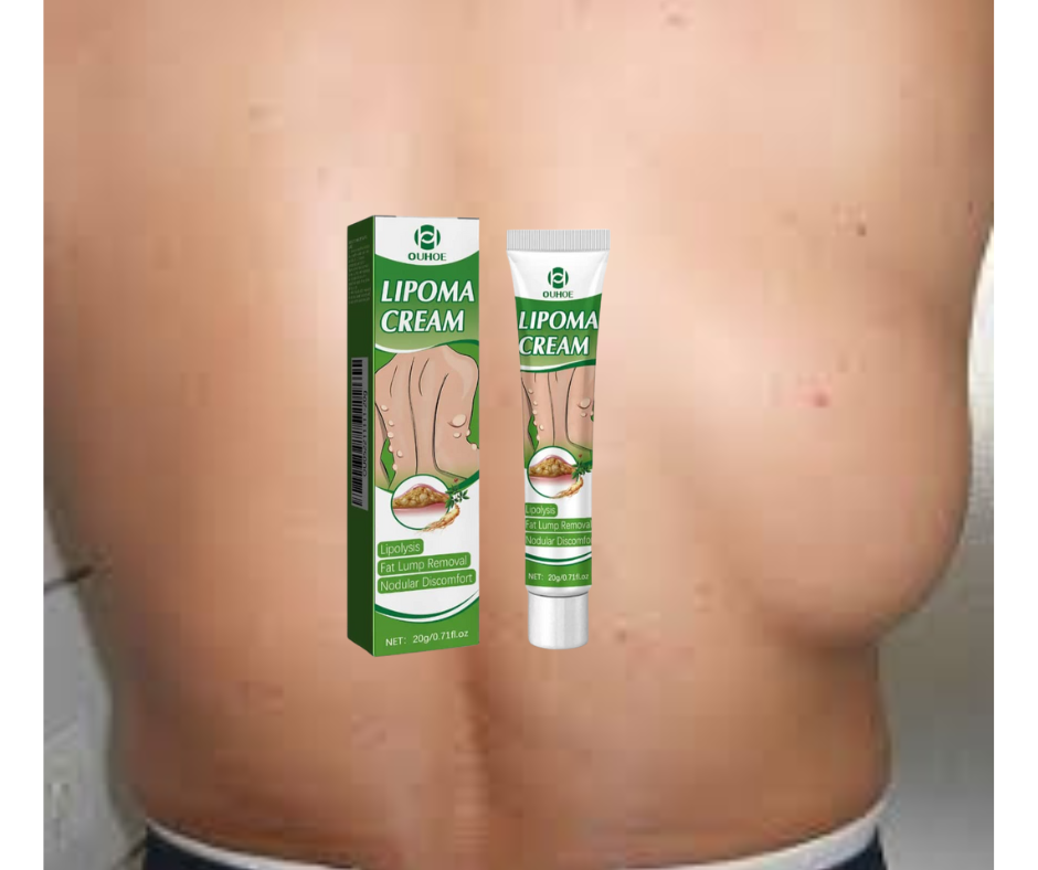 DITES ADIEU AUX LIPOMES, AUX KYSTES ET A TOUT TYPES DE BOULES SUR LE CORPS SANS CHIRURGIE EN QUELQUES JOURS AVEC NOTRE SOLUTION NATURELLE REVOLUTIONNAIRE
