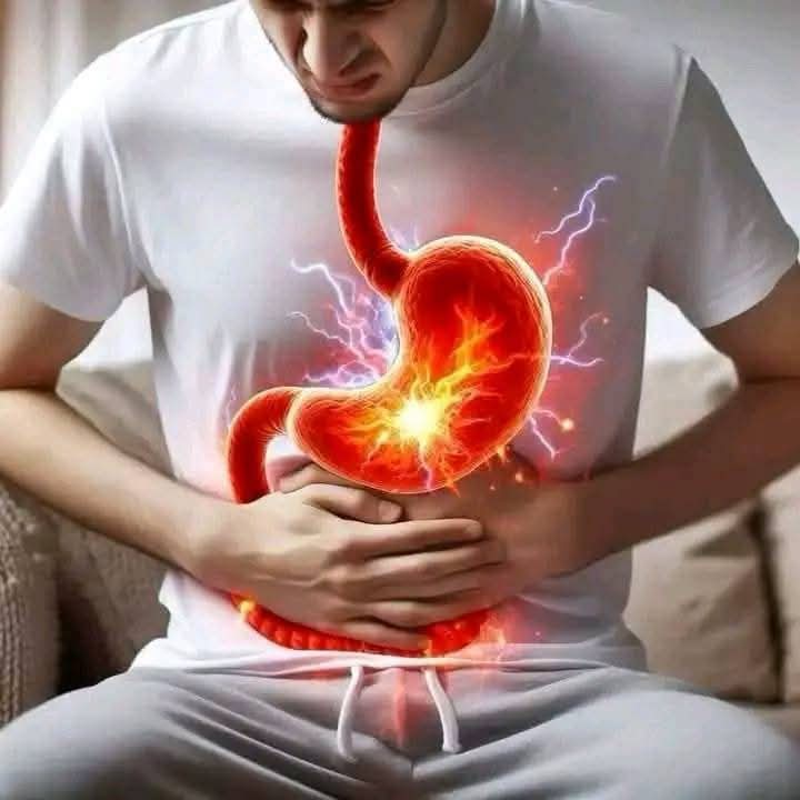 DITES ADIEUX A L'ULCERE (GASTRIQUE, BUCCAUX INTESTINAUX) ET A LA COLOPATHIE EN QUELQUES JOURS