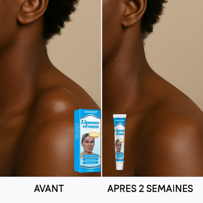 DITES ADIEUX AUX LIPOMES KYSTES GONFLEMENTS ET TOUT TYPE DE BOULE SUR LE CORPSS EN QUELQUES JOURS SANS CHIRURGIE AVEC NOTRE SOLUTION NATURELLE REOLUTIONNAIRE